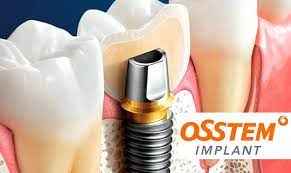 Имплантаты Osstem